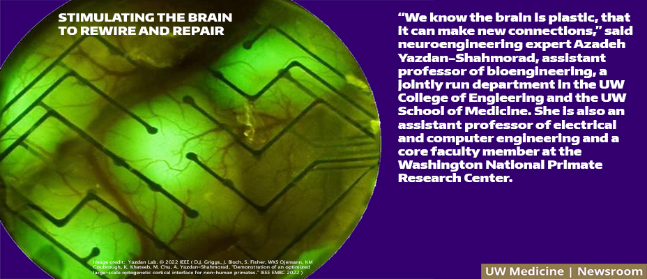 Stimulating the brain to rewire and repair